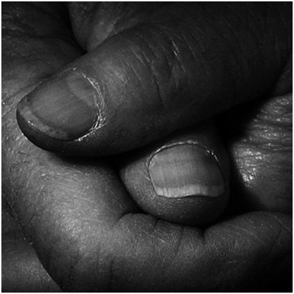 thumbs